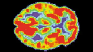Brain Scans Could Be Marketing Tool of the Future