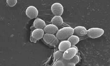 Gut Bacteria Involved in Colon Cancer