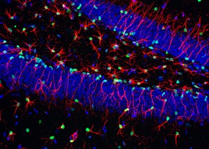 Neural Stem Cell Safeguards