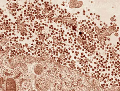 hiv-1-particles-large.jpg