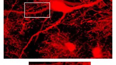 Artificial Stem Cells May Cure Parkinson’s Disease