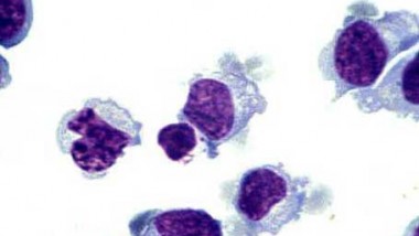 Innate Immunity to Cancer