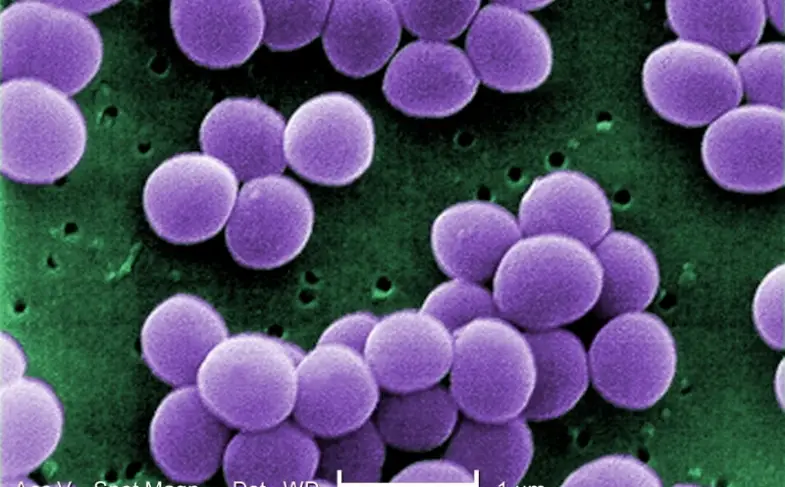 staphylococcus_aureus_visa_2.jpg