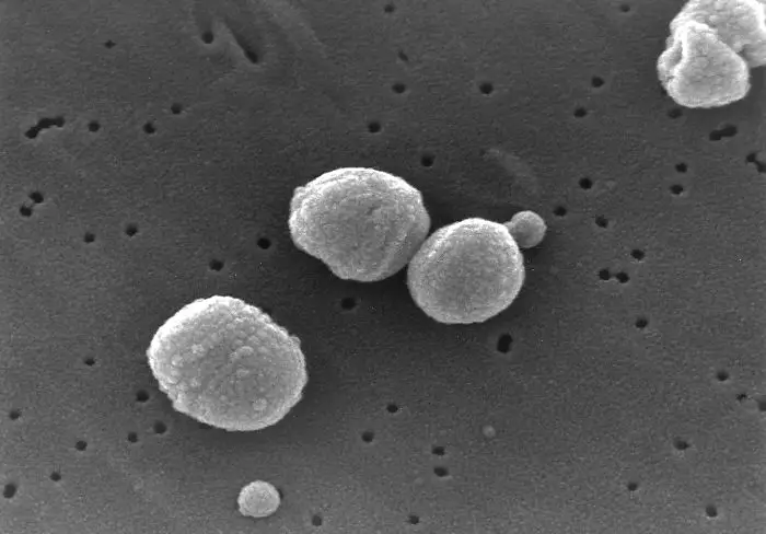 streptococcus_pneumoniae.jpg