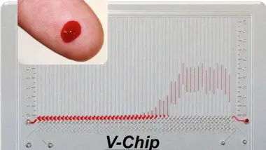 V-chip does 50 Tests with One Drop of Blood