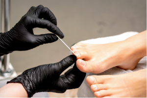 Antifungal Treatments