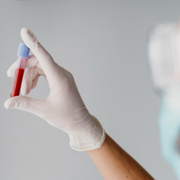 What Is a Full Blood Test to Check Everything?