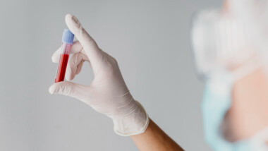 What Is a Full Blood Test to Check Everything?