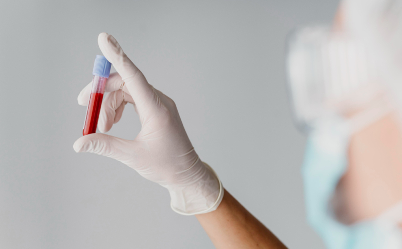 Full Blood Test