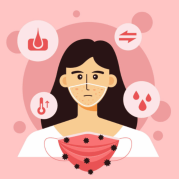 How To Treat Menstrual Acne Flare-Ups