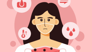 How To Treat Menstrual Acne Flare-Ups