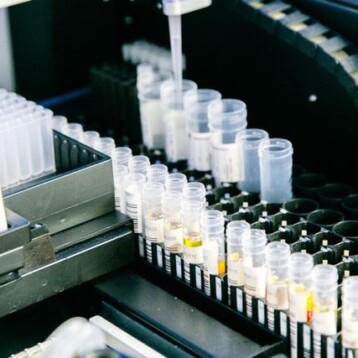 Best Central Lab Services For Biomarker-Driven Clinical Trials: Top Providers Compared