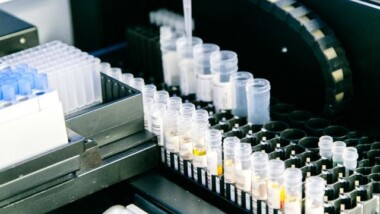 Best Central Lab Services For Biomarker-Driven Clinical Trials: Top Providers Compared