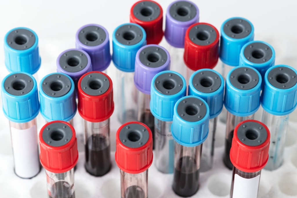 Disease PBMCs