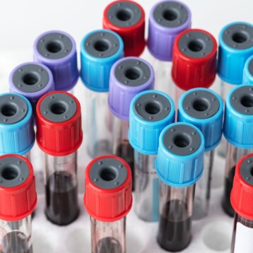 Disease PBMCs and Their Applications in Research