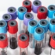 Disease PBMCs and Their Applications in Research