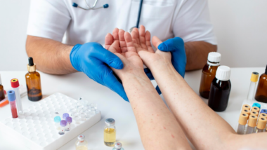 Questions to Ask Your Vein Doctor Before Beginning Treatment