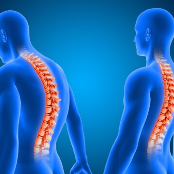 When a Spinal Cord Stimulator Fails: What Patients Experience