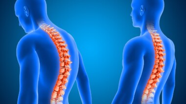 When a Spinal Cord Stimulator Fails: What Patients Experience